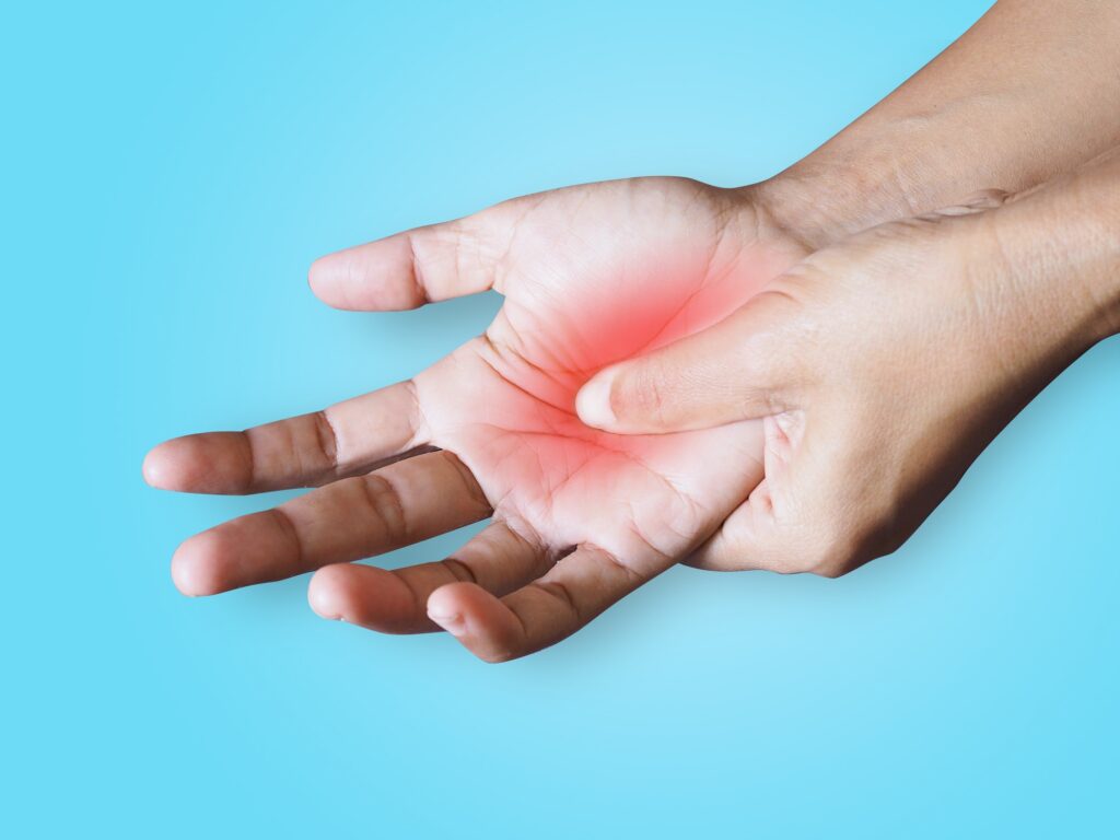 síndrome do túnel do carpo