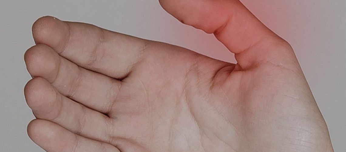 Tenossinovite de De Quervain